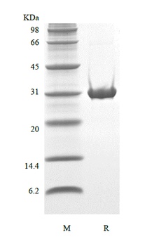 Recombinant Human TP53-induced Glycolysis and Apoptosis Regulator-TAT