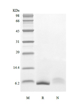 Recombinant Human Epiregulin