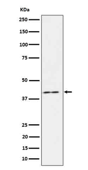 IL18 binding protein Rabbit Monoclonal Antibody