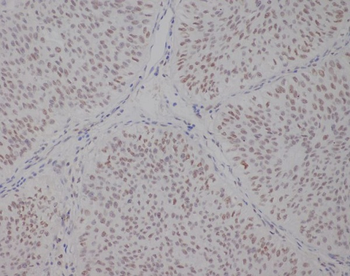 TFE3 Rabbit Monoclonal Antibody