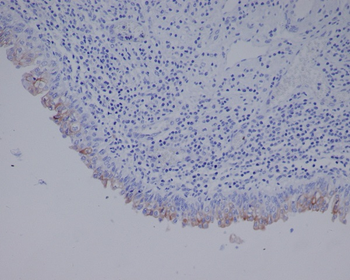 Uroplakin3a Rabbit Monoclonal Antibody
