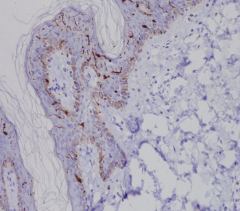 Langerin (CD207) Rabbit mAb Antibody