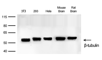 β-Tubulin Rabbit mAb Antibody