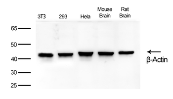 β-Actin Rabbit Monoclonal Antibody