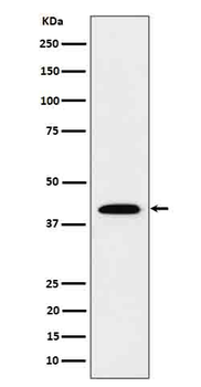 IL12B Rabbit Monoclonal Antibody