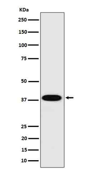 Cathepsin H Rabbit mAb Antibody