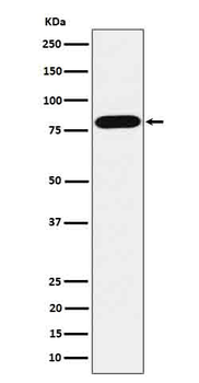 ABCD1 / ALD Rabbit mAb Antibody