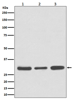 Caspase 3 Rabbit mAb  [KD Validated]