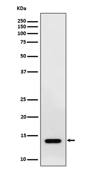 RNF7 Rabbit Monoclonal Antibody