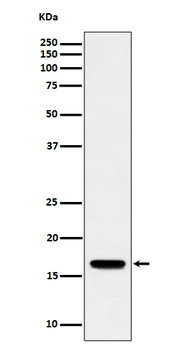 TCEB2 Rabbit mAb Antibody