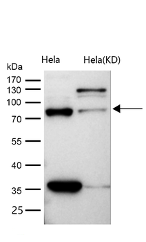 CSDE1 Rabbit mAb [KD Validated] Antibody