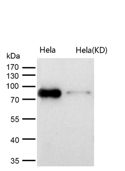 CSDE1 Rabbit mAb [KD Validated] Antibody