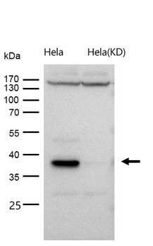 GNAQ Rabbit mAb [KD Validated] Antibody