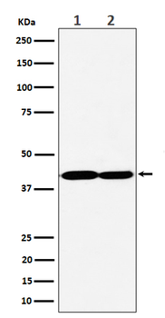 GNAQ Rabbit mAb [KD Validated]