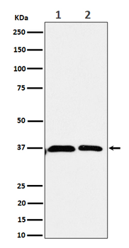 Serine racemase Rabbit mAb Antibody