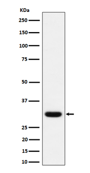Adiponectin Rabbit mAb Antibody