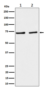 SLC25A12 Rabbit Monoclonal Antibody
