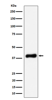 NSDHL Rabbit Monoclonal Antibody
