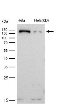 NUP155 Rabbit mAb [KD Validated] Antibody