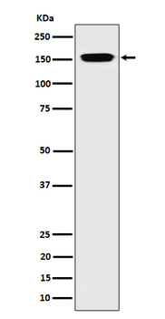 NUP155 Rabbit mAb [KD Validated]