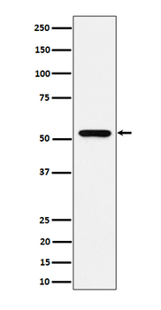 GRSF1 Rabbit mAb Antibody