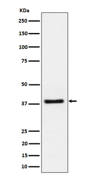 UCHL5IP Rabbit Monoclonal Antibody