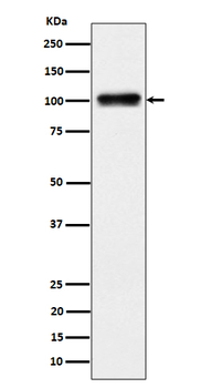 Nesprin3 Rabbit mAb Antibody