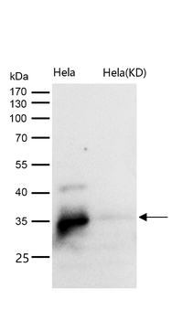 UCHL5IP Rabbit mAb [KD Validated] Antibody