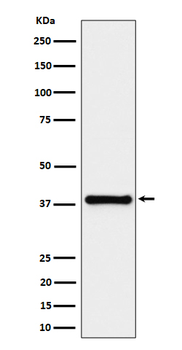 UCHL5IP Rabbit mAb [KD Validated] Antibody