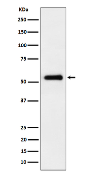 PRD Rabbit mAb [KD Validated]