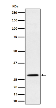 PSMB10 Rabbit Monoclonal Antibody