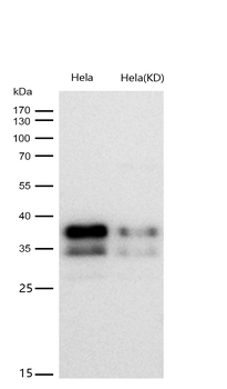 PCBP2 Rabbit mAb [KD Validated] Antibody
