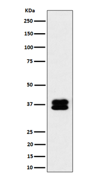 PCBP2 Rabbit mAb [KD Validated] Antibody