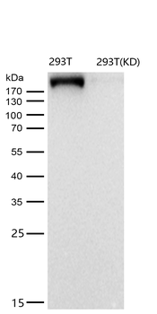 IQGAP2 Rabbit mAb [KD Validated]