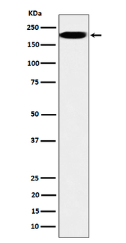 IQGAP2 Rabbit mAb [KD Validated]