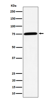 PPM1G Rabbit mAb [KD Validated]