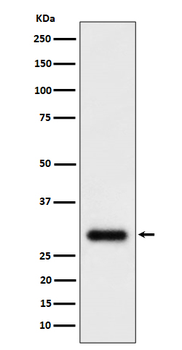 TMEM192 Rabbit Monoclonal Antibody
