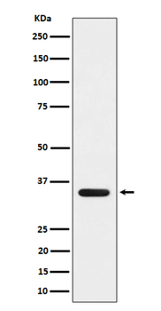 MLD Rabbit mAb [KD Validated] Antibody