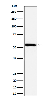 AER61 Rabbit mAb [KD Validated] Antibody