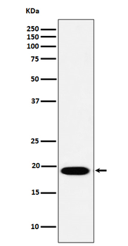 MSRB3 Rabbit mAb Antibody