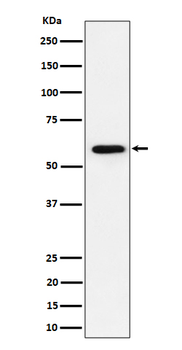 PRPF31 Rabbit mAb Antibody