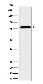 PRMT7 Rabbit mAb [KD Validated]