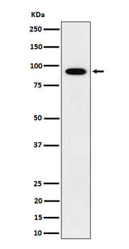 IFT88 Rabbit mAb Antibody