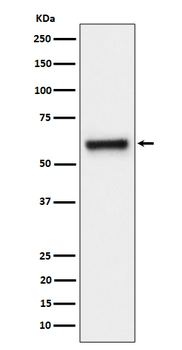 FPGS Rabbit mAb Antibody