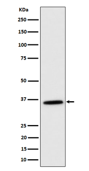 MDH2 Rabbit Monoclonal Antibody