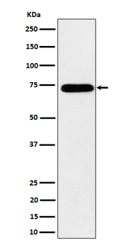 HNRNPM Rabbit mAb [KD Validated]