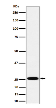 TEMT Rabbit Monoclonal Antibody