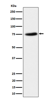 PPM1G Rabbit mAb [KD Validated]