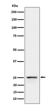 PEX11B Rabbit mAb Antibody