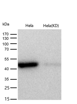 AdSS 2 Rabbit mAb [KD Validated] Antibody
